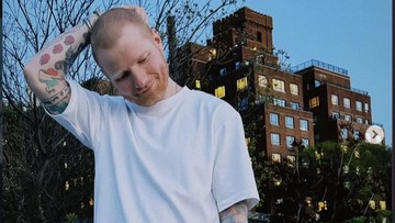 Mengenal Penyakit Herpes Zoster yang Bikin Ed Sheeran Botak/Foto: Instagram