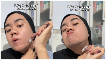 Kisah Inspiratif Sahriyah, Wanita Muda Madura Pejuang Hirsutisme di Tengah Sorotan Publik