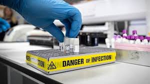 Kasus Hantavirus Terdeteksi di Swiss, Waspada Potensi Penularan Terkait Kapal Pesiar Global