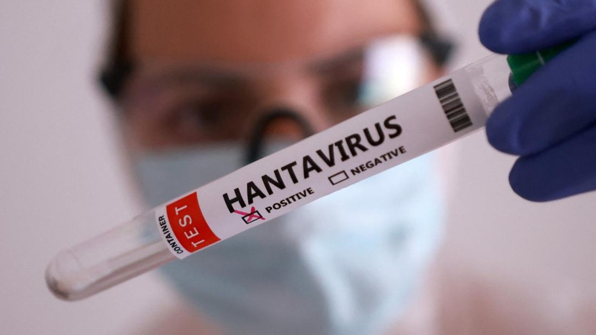 Kemenkes Ungkap Data 23 Kasus Hantavirus di Indonesia: Kenali Varian Lokal dan Gejala Klinisnya