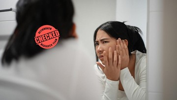 Jerawatan akibat salah makan. Foto: iStock