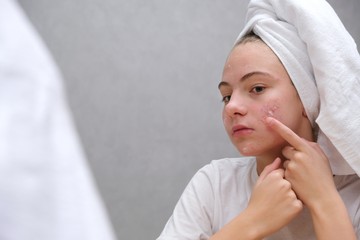 Panduan Tepat Memilih Produk Perawatan Wajah untuk Kulit Sensitif, Berminyak, dan Rentan Berjerawat