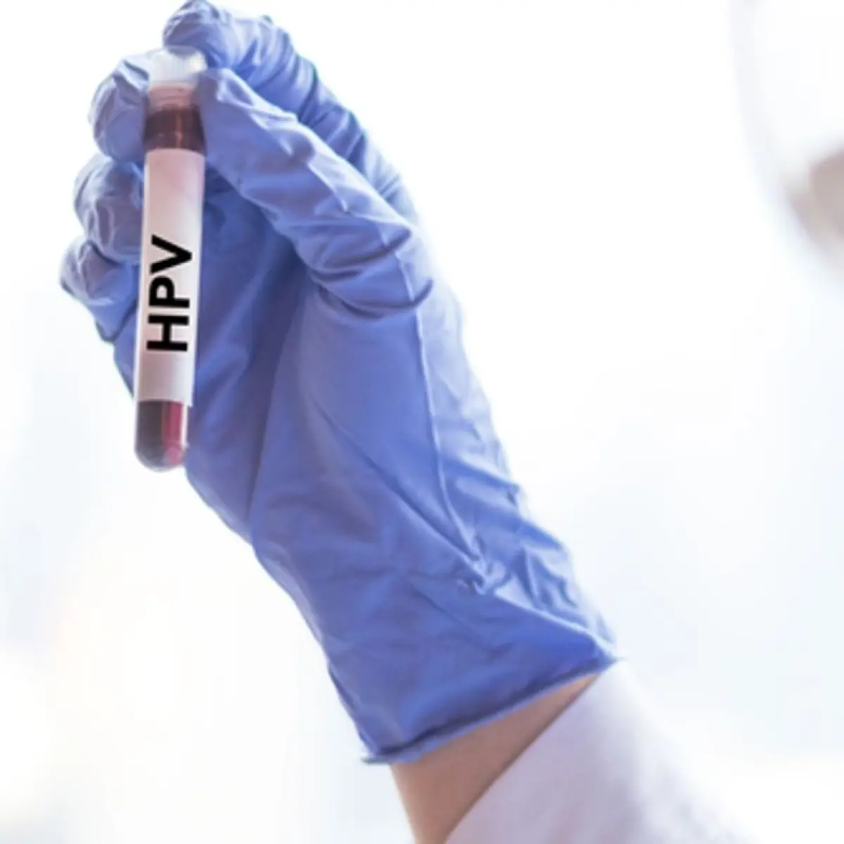 Ilustrasi HPV (Freepik)