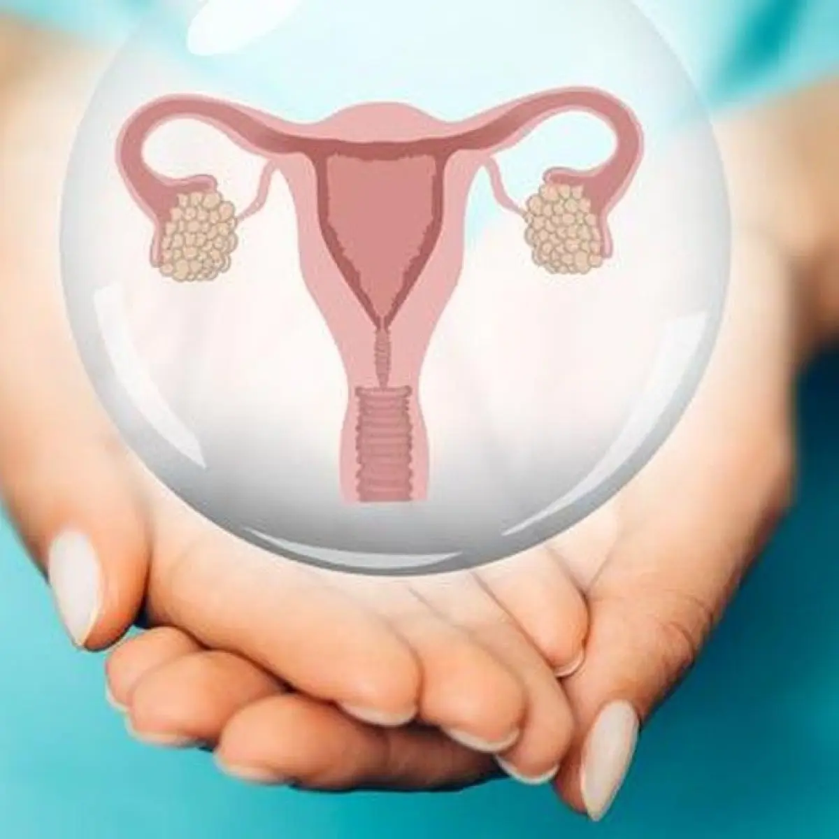 Foto: ilustrasi kista ovarium (Getty Images/fotostorm)
