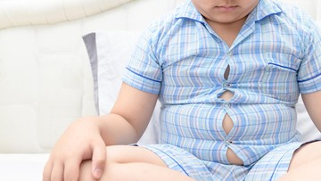 Stop Menyalahkan Susu! Pakar FKUI Ungkap Kesalahan Umum Penanganan Obesitas Anak