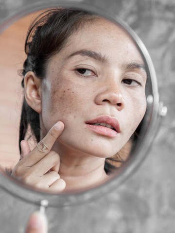 Mengupas Tuntas Hiperpigmentasi: Riset Ungkap 73% Wanita Indonesia Hadapi Masalah Warna Kulit