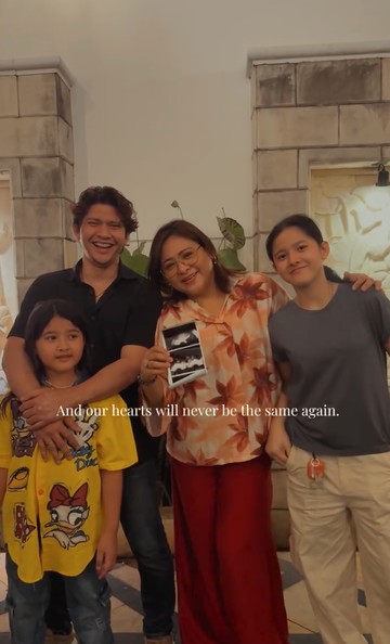 Perayaan 14 Tahun Pernikahan Audy Item dan Iko Uwais Diwarnai Kabar Bahagia Kehamilan Ketiga
