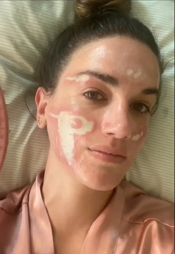 Kisah Pilu Konsumen Facial Mewah Berujung Cacat Permanen, Tuntut Kompensasi Miliaran