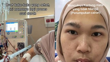 Kenali Gejala Awal Gagal Ginjal Stadium 5, Wanita Bekasi Ini Bagikan Pengalaman Cuci Darah