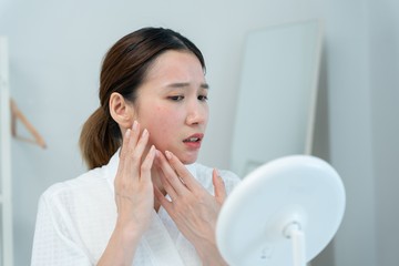 Melasma: Mengungkap Misteri Noda Gelap di Wajah, Pemicu, dan Solusi Dermatologis Terkini
