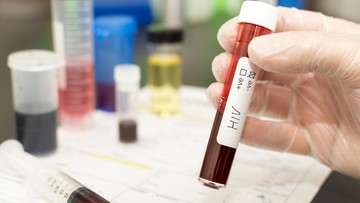 Kemenkes RI Klarifikasi Data HIV Sidoarjo: Deteksi Dini Berhasil, Bukan Lonjakan Kasus